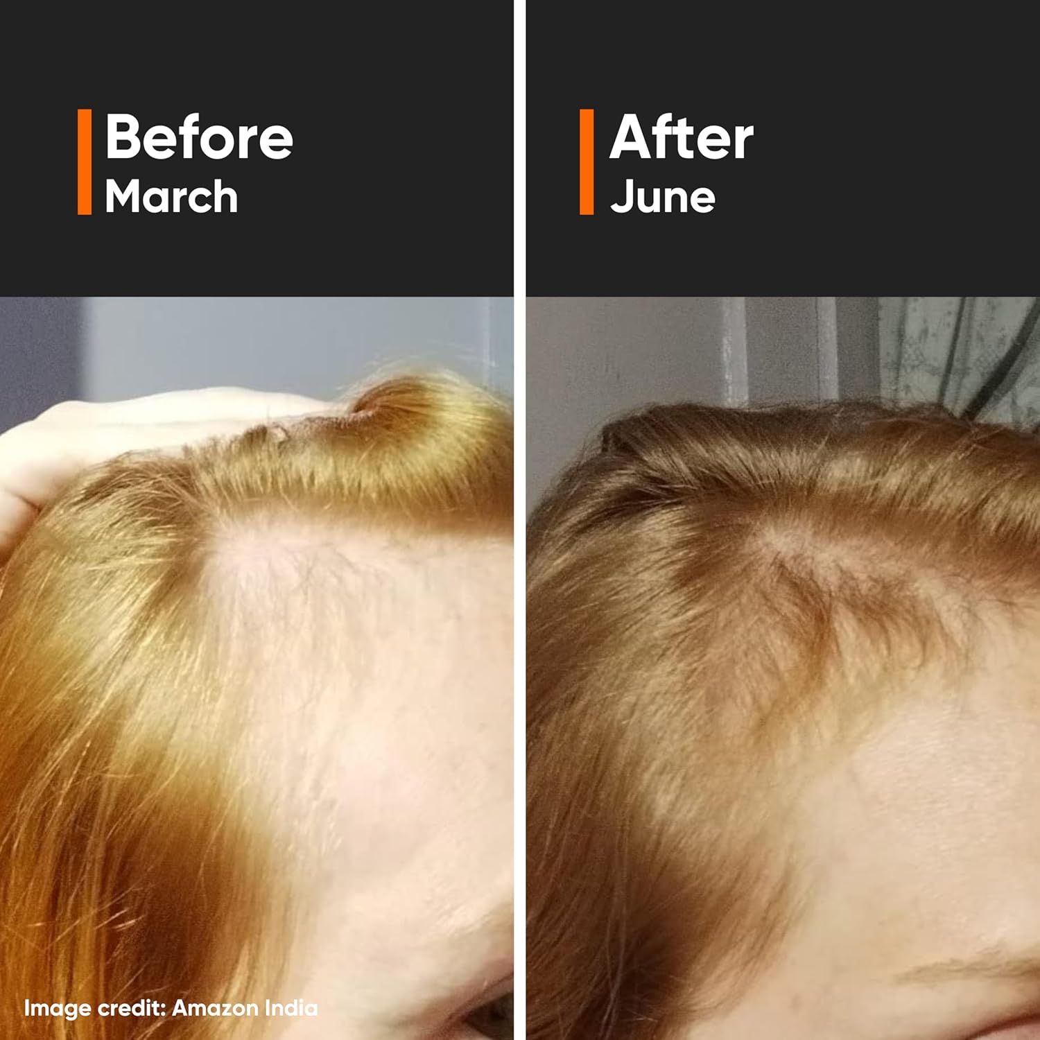 Minimalist Hair Growth Serum | 3% Redensyl, 3% Anagain, 3% Procapil, 5% Capixyl & 4% Baicapil 18% Hair Growth Actives | For Hair Fall Control in Men & Women | 30 ml