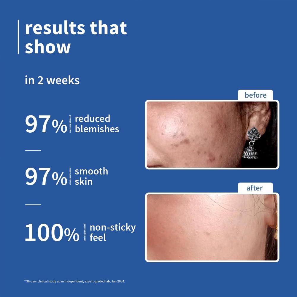 Plum 10% Niacinamide Serum with Rice Water | 10ml | Provides Clear, Glowing & Brightening Skin | Oil Control & Anti Acne Face Serum for Women & Men